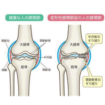 は たまる に なぜ が 水 の 膝